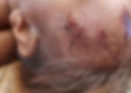 Pai atinge bebê de um ano e 4 meses com foice ao tentar agredir a companheira em MS