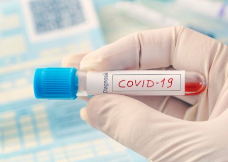 Com 474 novas mortes, Brasil registra mais vítimas da COVID-19 que a China