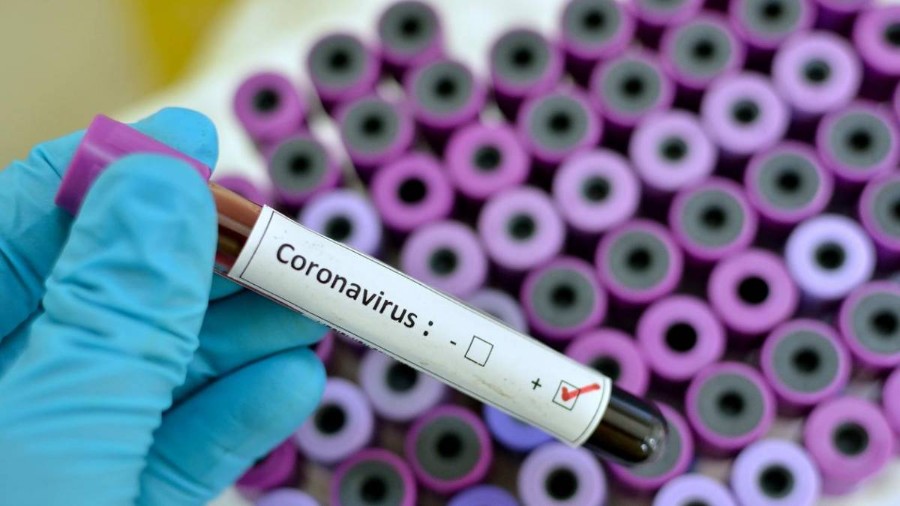 Brasil registra 177.589 casos de coronavírus e 72.597 pessoas recuperadas