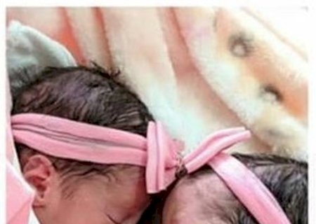 Recém-nascidas gêmeas morrem após serem atacadas por cachorro da família
