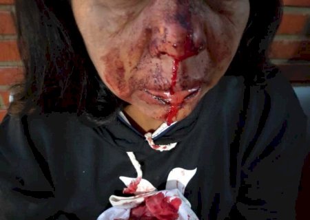 Mulher é agredida com garrafadas no rosto por adolescente