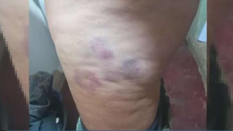 Mulher foge depois de passar três dias sendo espancada e estuprada em cárcere privado