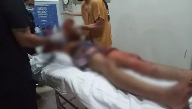 Jovem de 18 anos morre em troca de tiros com polícia