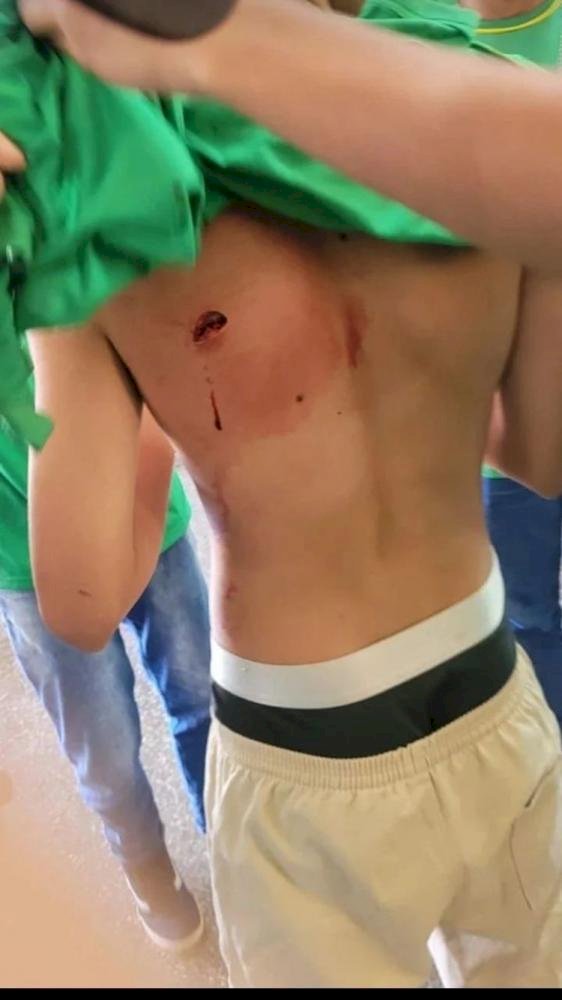 Briga entre alunos deixa um ferido a facadas em Ponta Porã