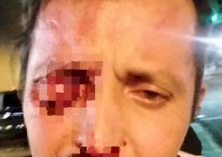 Homem cai sobre haste de retrovisor e perde olho durante briga de rua.