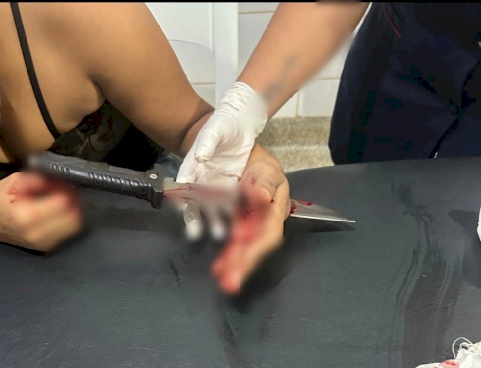 Mulher que teve faca cravada na mão pelo ex-marido é liberada do HV